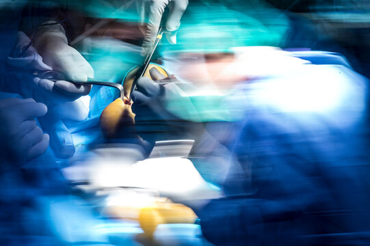 Male surgeons performing achilles tendon in operating room at hospital