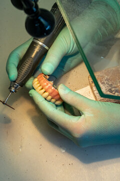 Polishing the dental prosthesis at Dental Clinic