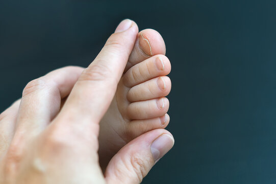 A mother holds a small bare foot of a child against a dark background in close-up. A woman's hand massages a child's leg. A torn toenail on the thumb of a two-year-old girl. Selective, soft focus.