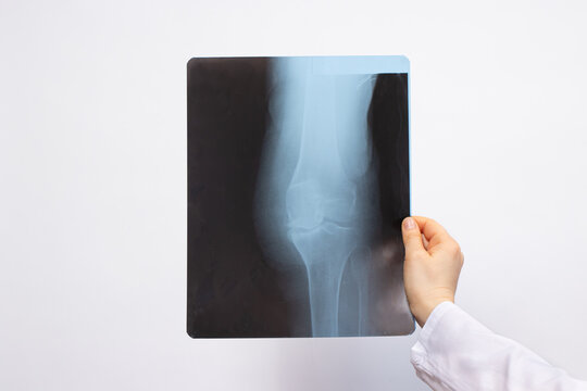 The doctor examines an X-ray of a patient with a knee injury on a white background with a place for text