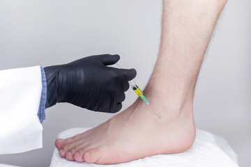 An orthopedic surgeon injects medicine into the Achilles tendon to relieve pain. Help treat...