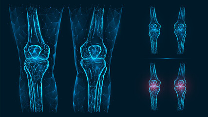 Abstract polygonal illustration of human knee anatomy. Disease, pain and inflammation of the knee joints isolated on blue background. - obrazy, fototapety, plakaty