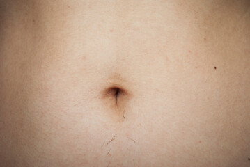 
Female belly with hair near the navel.
Hair removal concept.Before epilation. Close-up. Woman with high testosterone.