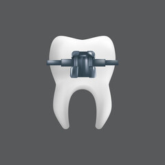 A tooth with a metal brace. Orthodontic treatment concept. 3d realistic vector illustration of a dental ceramic model isolated on a grey background