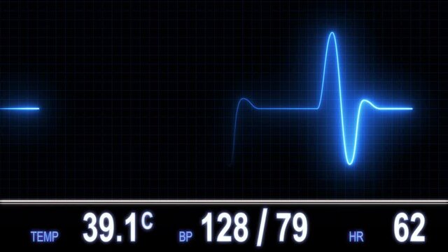 heart monitor flatline gif