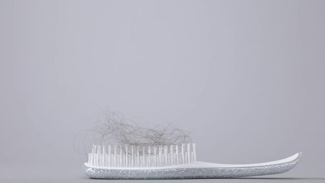 Alopecia. A male's hand puts down a hair brush with a bunch of fallen hair. Side view. Gray background. The concept of hair loss