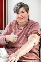 mentally disabled or handicapped woman has a patch on her upper arm after a vaccination
