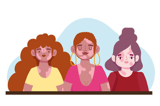 diverse female with vitiligo group cartoon character self love