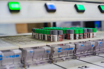 Blood test tubes in modern science laboratory at the hospital.