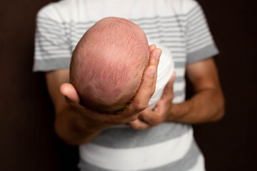 the child's head in the hands of parents. the head of the newborn in the hands of his father. the little head of a newborn