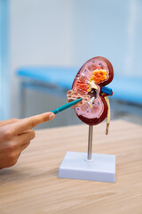 Plastic bladder in the doctor's office. Visual material of kidney for the urologist. Blurred...