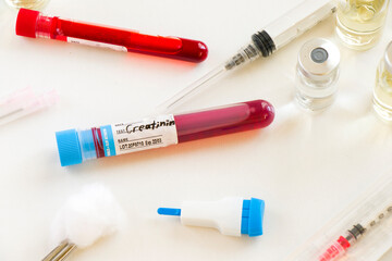 Creatinine blood test tube sample in doctors hand in laboratory