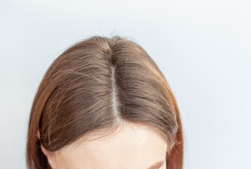 A woman's head with a parting of gray hair.