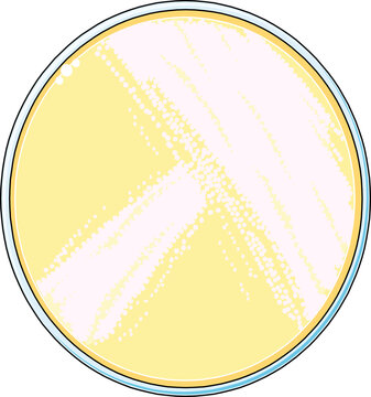 Top view of a Petri dish filled with nutrient agar media and growing colonies of bacterial cell culture