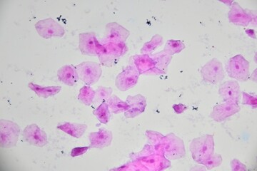 Cells of human oral mucosa - 