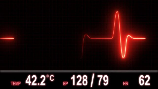 Red Heart Rate Monitor Graphic