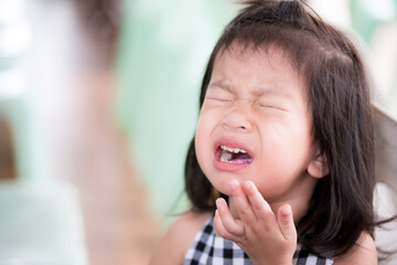 One little cute Asian child girl suffers sores on the oral tissue. The child cries and cries when...