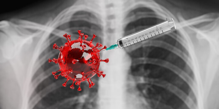 Vaccine Against Covid-19 Concept: Close Up On 3D Rendered Red Transparent Corona Virus Cell With A Medical Needle Inserted. In Background The X-ray Film Of Human Lung In Blurry Black And White.