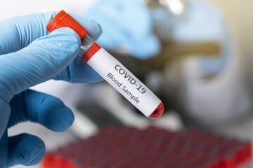 Fototapeta premium Cropped view of scientist in latex glove holding test tube with blood sample, Test tube with blood sample for COVID-19 test, novel coronavirus 2019