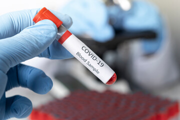 Fototapeta premium Cropped view of scientist in latex glove holding test tube with blood sample, Test tube with blood sample for COVID-19 test, novel coronavirus 2019