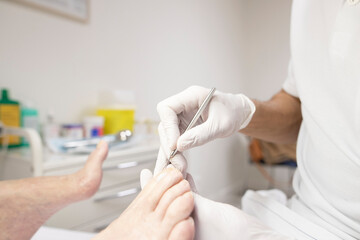 a podiatrist takes care of a patient's nails