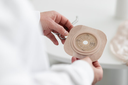 an ostomy therapist prepares an ostomy pouch