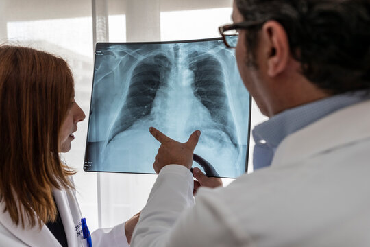 two doctors read a chest x-ray
