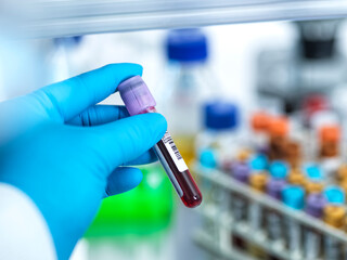 Medical technician preparing human samples for medical testing in lab