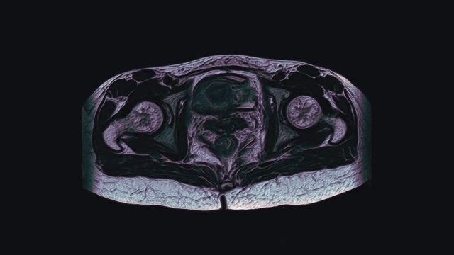 Voluminous color MRI of the female pelvic organs, abdominal cavity, gastrointestinal tract and bladder