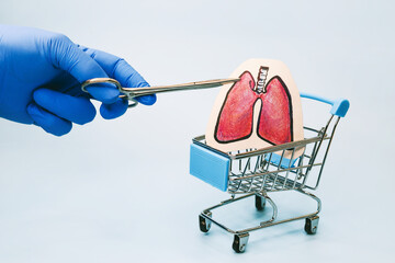 illegal market for organ donation.