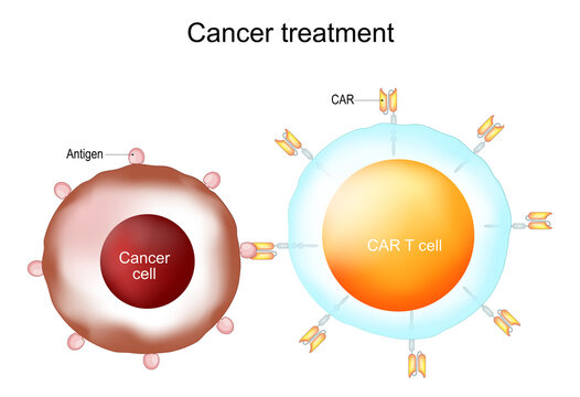 Cancer treatment and CAR T-cell therapy