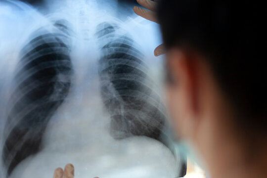 A female pneumologist holds a lung scan in her hands