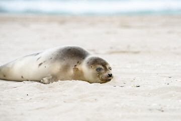 A sick seal on the sand at the New Jersey shore