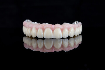 Quality dental prosthesis made of titanium beam and ceramics for fixation to the upper jaw. Teeth treatment.