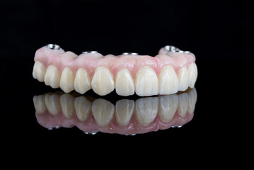 Quality dental prosthesis made of titanium beam and ceramics for fixation to the upper jaw. Teeth treatment.