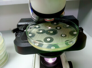 Petri dish with antibiotic susceptibility stands under microscope. microscopic examination of...