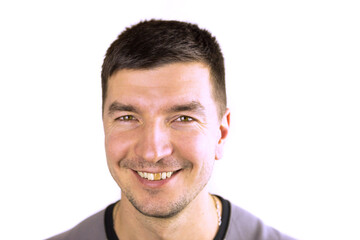 Obraz premium Yellow damaged tooth of a smiling Caucasian man in close-up. Focus on the teeth. Dental problems, dead teeth, enamel whitening, aesthetic restoration. Natural enamel, body positive