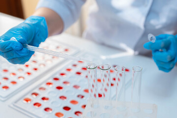Laboratory determination of blood type. Blood test