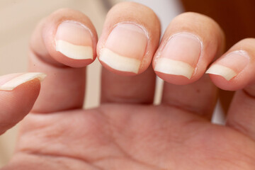 Hand Finger With Long Nail