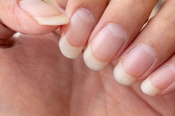 Hand Finger With Long Nail