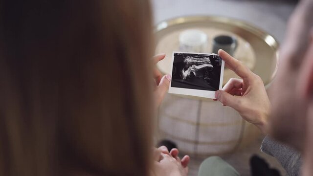 Young pregnant couple holding hands and looking ultrasonic picture shot in 4k
