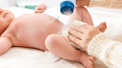 Closeup of mother applying talcum powder while changing messy diapers of her little baby son on changing table. Concept of babies and newborn hygiene and healthcare. Caring parents with little