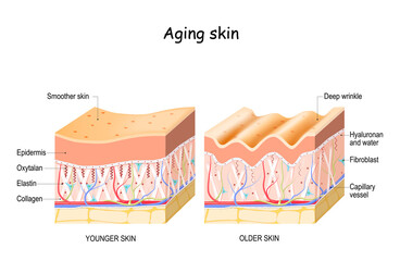 Aging skin. collagen, elastin, and Oxytalan fibers. Hyaluronic acid