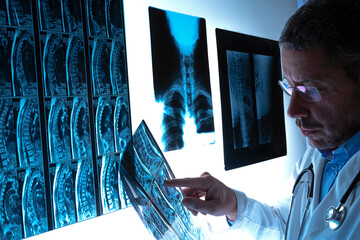 Radiologist examining spinal column by radiography, x-ray and magnetic resonance imaging scan....