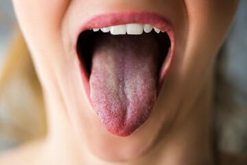 Healthy Woman Mouth