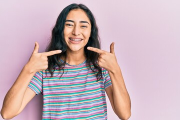 Hispanic teenager girl with dental braces wearing casual clothes smiling cheerful showing and...