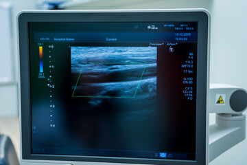 Image of modern ultrasound monitor. Ultrasonography machine