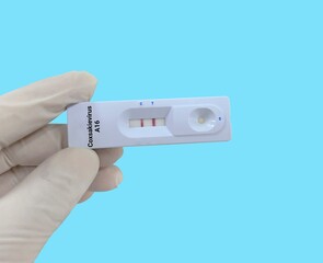 Biochemist or Lab Technologist holds a Device of Coxsackievirus A16 rapid screening test. Device...