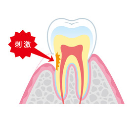 Tooth cross section_19