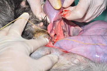 surgical operation to remove the uterus